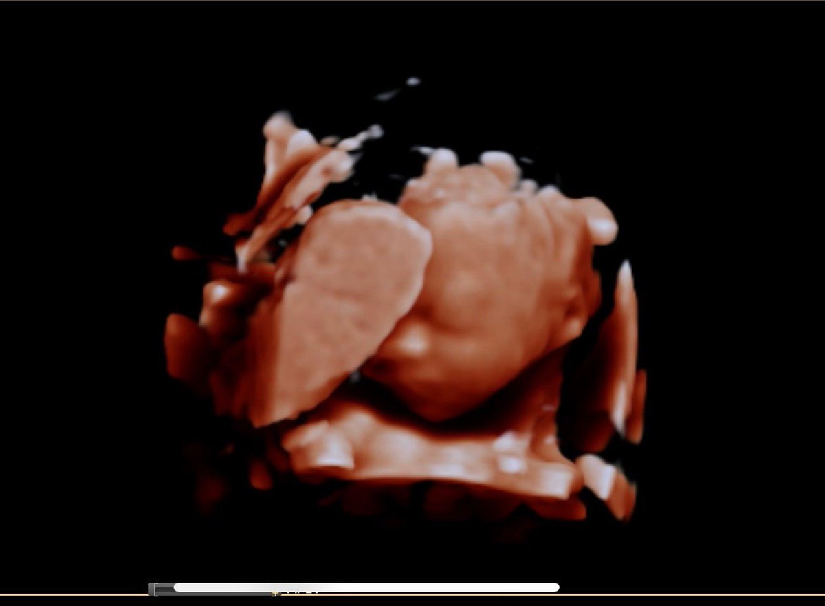 We can’t wait to meet you in March…

The Lord has blessed us with the chance to expand our family again and help teach and reflect His wondrous love anew… and has blessed Clara Grace with a brother or sister… we are so thankful as we begin 2024.

Great is thy faithfulness…