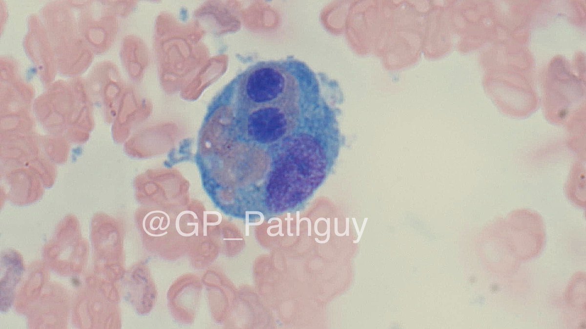 Glenn Murray tweet media