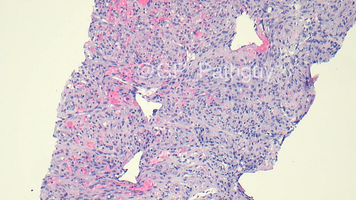 Glenn Murray tweet media