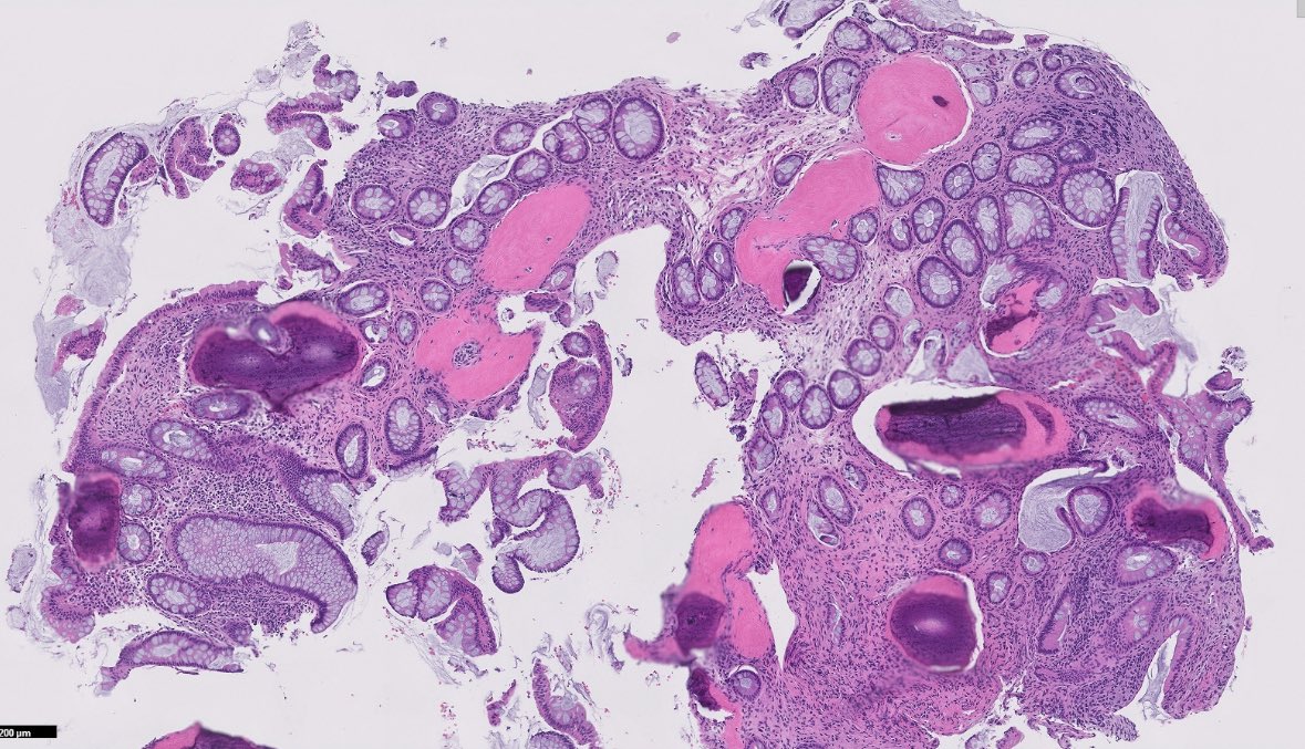 OhioStatePath's tweet photo. What do you ๐? #pathresidents #pathnewbies
#PathTwitter #pathx https://t.co/rX1rI1zGki
