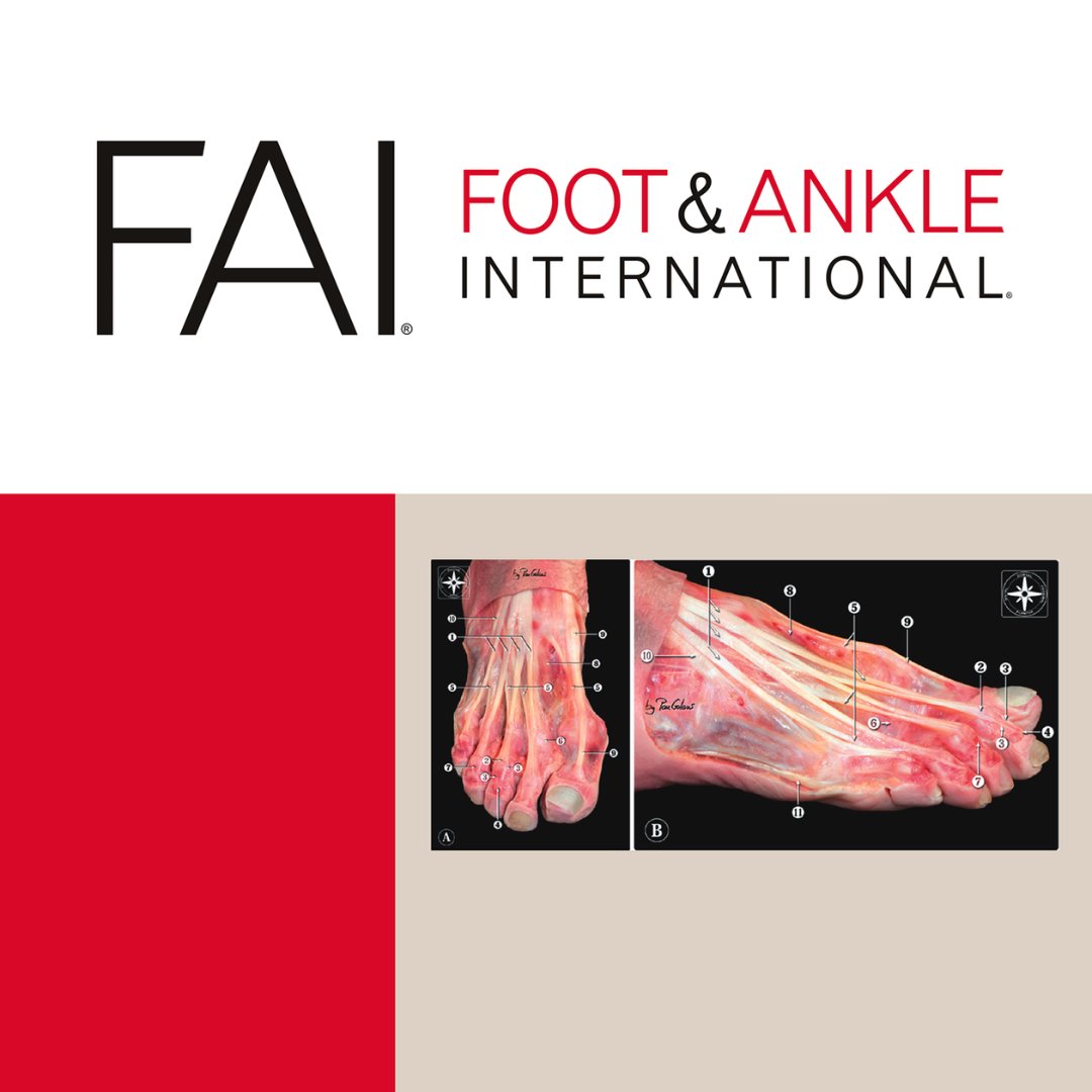 PROMIS PF and PI objectively assess physical function and pain in foot and ankle patients. 

Read the contemporary review in FAI: doi.org/10.1177/107110…   

 <a href="/OrthoColumbia/">Columbia Orthopedics</a> <a href="/NatCzerwonka/">Natalia Czerwonka, MD</a> <a href="/sdesai_1/">Sohil Desai, MD</a> <a href="/ArcieroEmily/">Emily Arciero</a> <a href="/drgreisbergmd/">Justin K. Greisberg, MD</a> <a href="/DavidTrofaMD/">Dr. David Trofa</a>