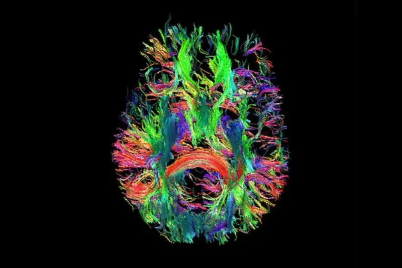 dpture2's tweet photo. Stunning Images Unveiled by #neuroscience : Awe-Inspiring Visuals from the Field
https://t.co/LWz2J6BFL6
#neuropsychology #PHOTOS #photography #photooftheday https://t.co/FOAkuO1J4E