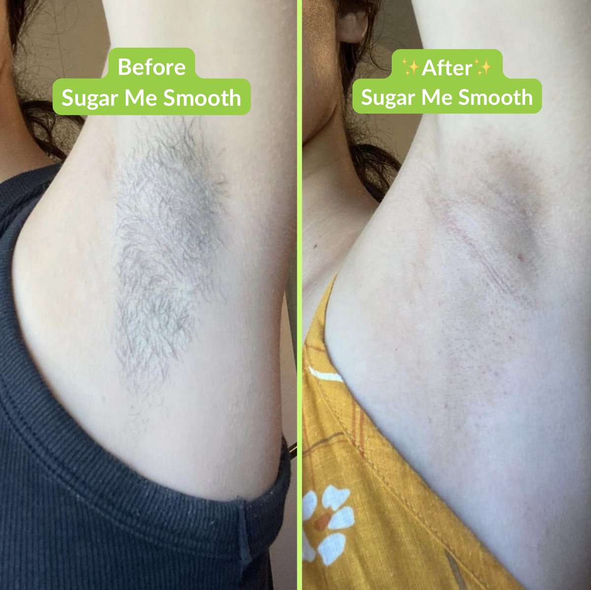 SugarMeSmooth's tweet photo. Hair removal that's actually good for your skin! No strips, no heat, and less pain! Our Sugar Wax works great on all hair and skin types and leaves you smooth and hair free for weeks!

#sugarwaxkit #sugarwaxing #allnatural #athomesugaring https://t.co/tdwbELqhrT