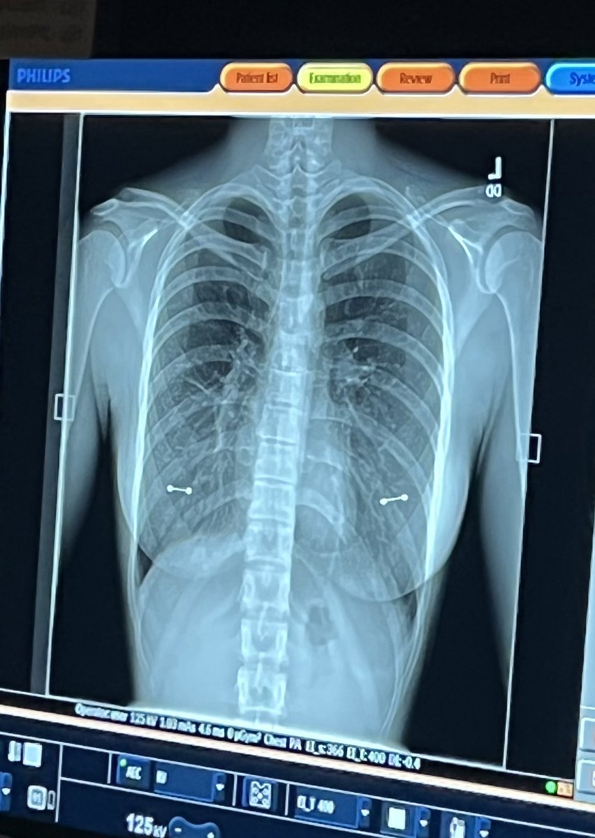 Had this bad boy taken a while ago and forgot to share… hope you enjoy~