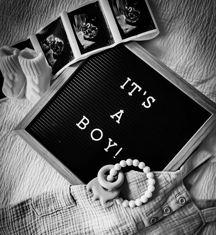 ⠀⠀
O ultrassom de hoje me rendeu uma surpresa maravilhosa. Vou ser mãe de um garoto. Muitas pessoas, inclusive mi madre, me disseram que seria uma menina. Mas quem está vindo, é o meu pequeno Ramon. 🖤 Não consigo explicar o amo incondicional que estou sentindo.
⠀⠀