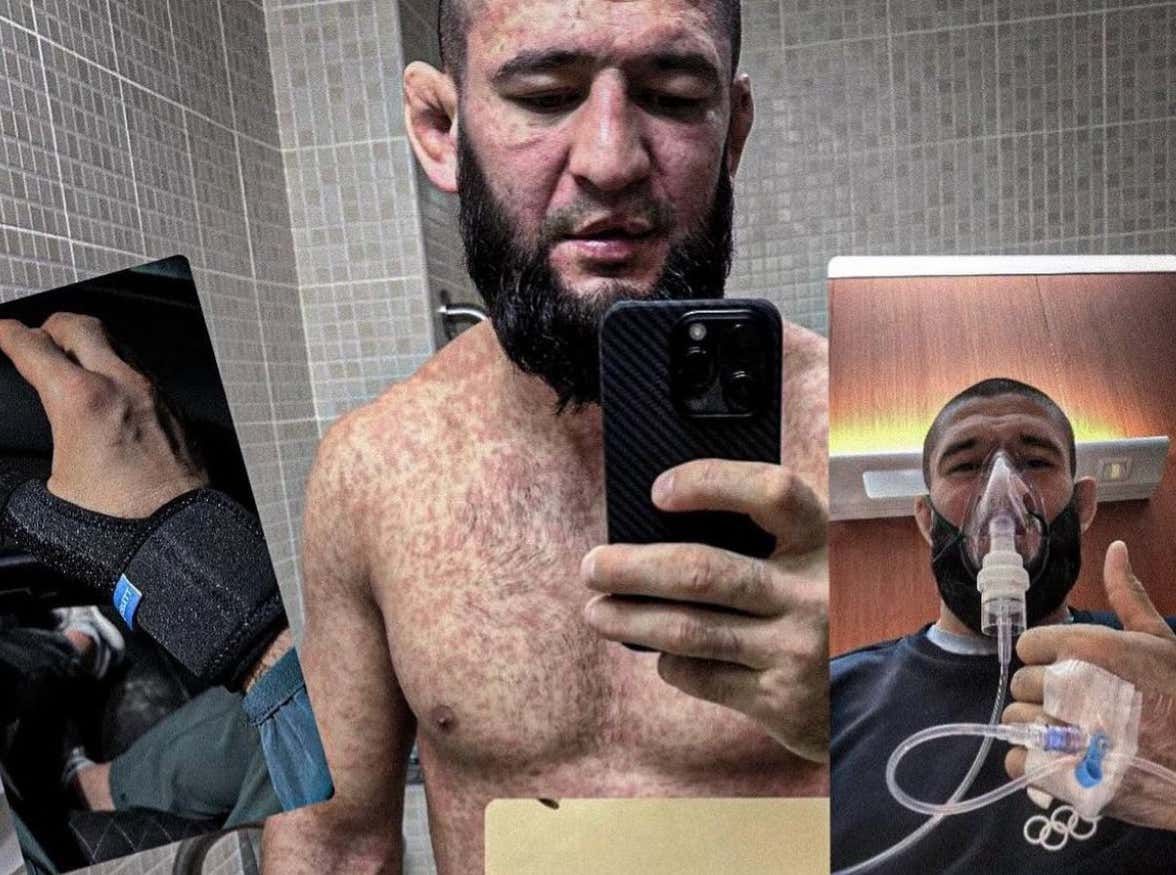 Khamzat Chimaev Posts Strange Photos Of Him Battling Sickness Where He Looks TERRIBLE barstoolsports.com/blog/3498706/k…