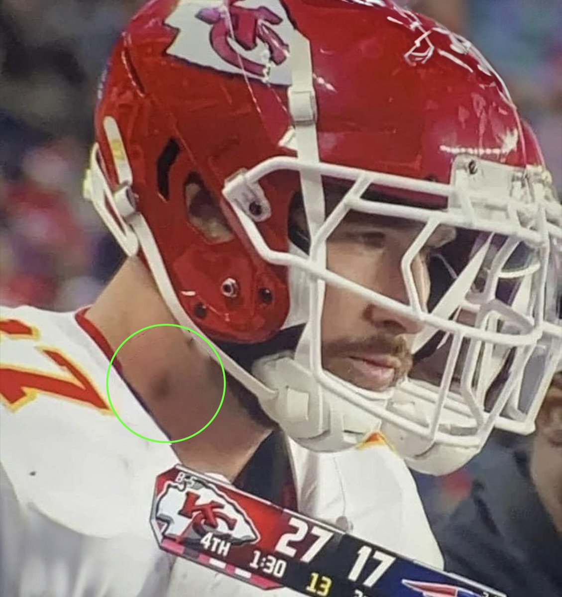 Taylor sucked the talent right out of him 💀