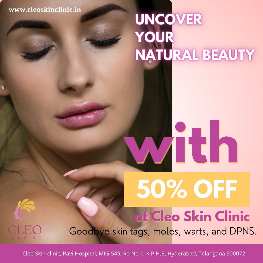 Reclaim your natural beauty! Say goodbye to skin tags, moles, warts, and DPNS that may disrupt your skin's smoothness. Enjoy 50% off and rediscover your true beauty at Cleo Skin Clinic
#NaturalBeauty #SkinCare #CleoSkinClinic #SkinRejuvenation #RediscoverYou #BeautyDeal