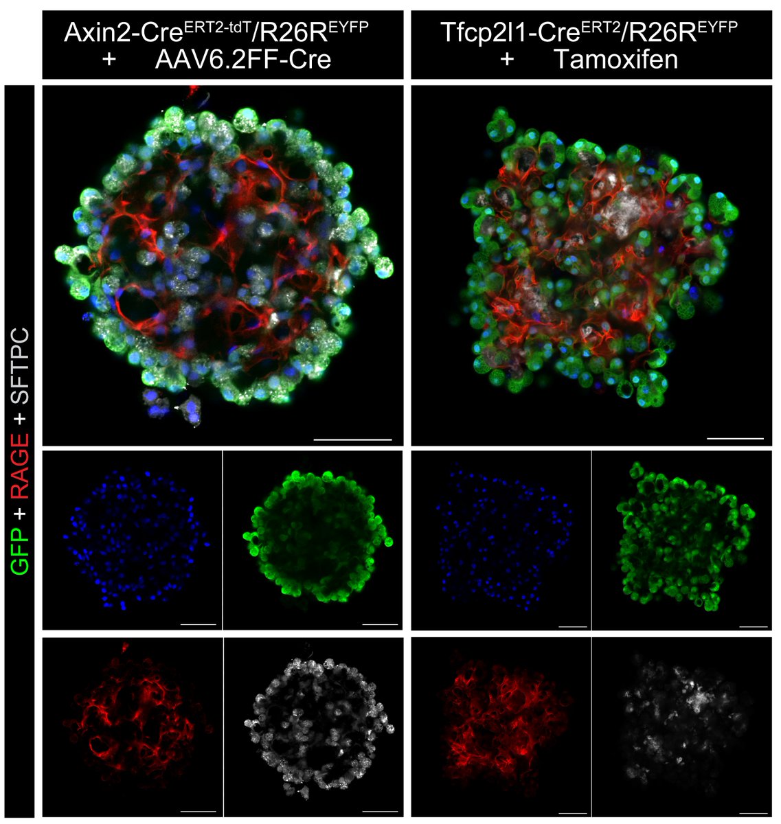 atoth147's tweet photo. We validate use of Tfcp2l1-CreERT2 for adult in vivo studies, with direct comparison to Axin2-CreERT2-tdt. Also, we show that organoids from Tfcp2l1+ adult epithelial cells clonally expand into organoids with similar structural/cellular complexity (compared to Axin2+ organoids). https://t.co/qnASwscwsp