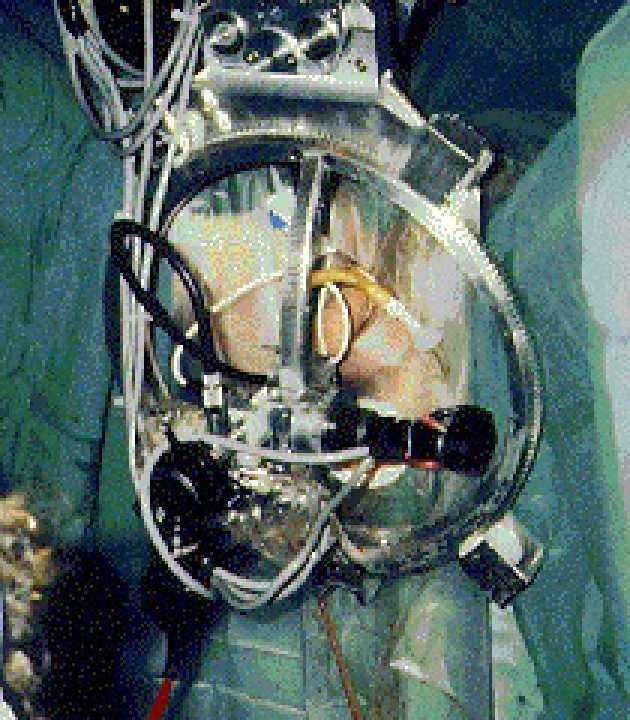 benchallacombe's tweet image. Christmas present/Christmas past. Amazing to be doing Aquablation prostate robotics with our fantastic @GuysUrology team 30yrs on from the first autonomous prostate surgery, in the same theatre! #probot @PROCEPTRobotics  @GSTTnhs