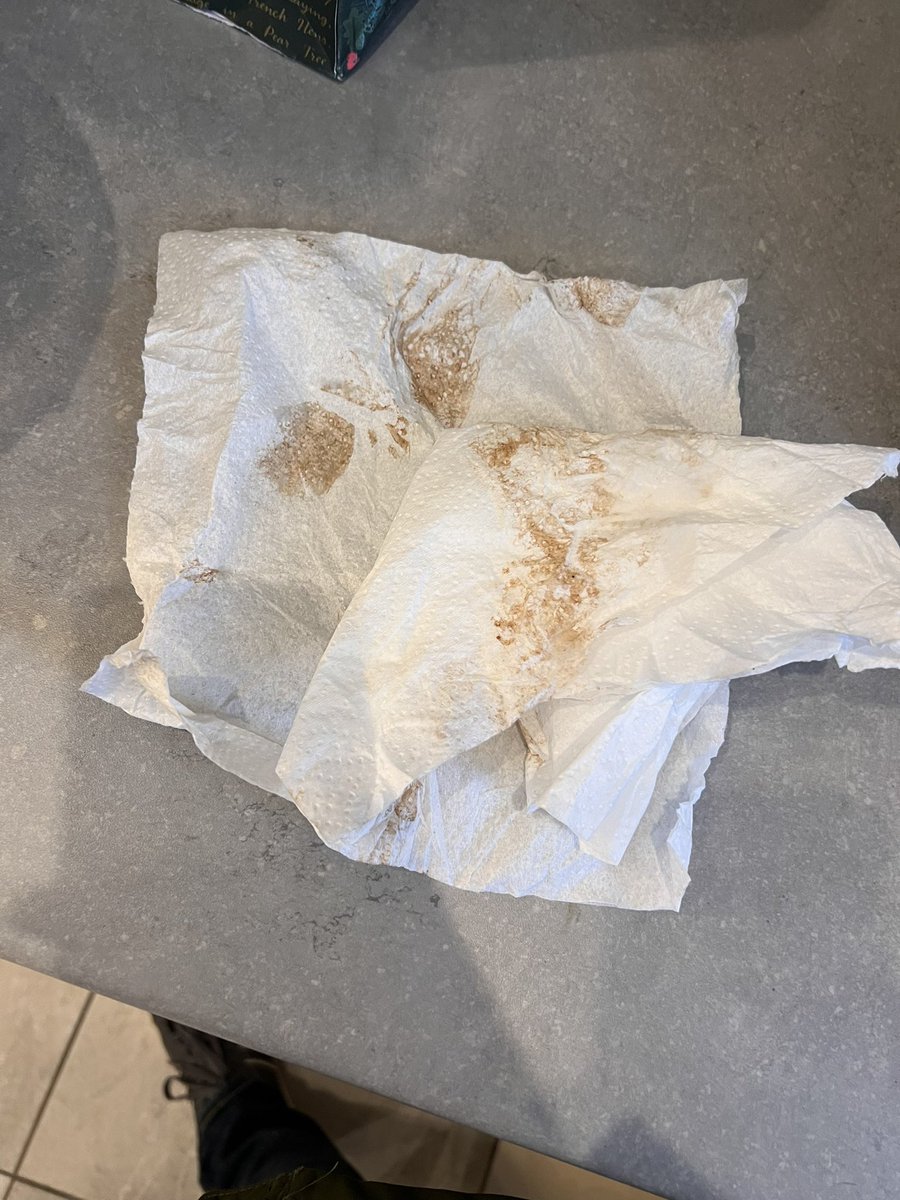 Jack_A94's tweet photo. @marksandspencer So disappointed and dissatisfied with your customer service today. You don’t expect to find your Christmas food order opened, unknown how long for and told take it or leave it. Then have to get home and clean them! How do I complain? https://t.co/5644YN2GL0