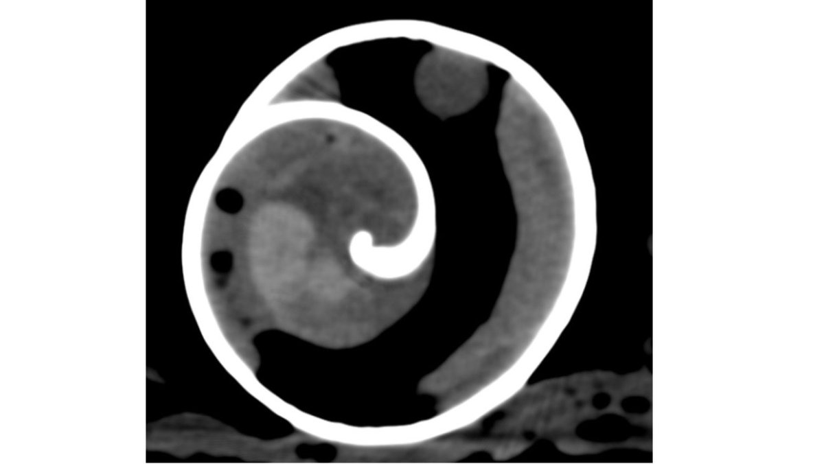 Yesterday's highlight in the CT <a href="/uzh_vetsuisse/">Vetsuisse-Fakultät Zürich</a>  - an African giant land snail!
It is very interesting, all the details that can be recognised - for example the lung sack is well visible here.