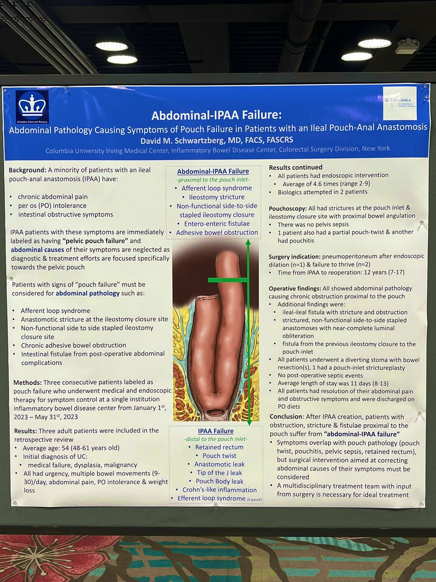 SchwartzbergMD's tweet photo. From #AIBS2023 
My proposal  to more effectively classify #IPAA pathology
To use Pelvic-IPAA failure (IPAA twist, retained rectum, anastomotic leak, pouchitis) vs Abdominal-IPAA failure (adhesions, stoma site stricture/non function, ALS, anastomotic leak ->abscess/fistulae) has https://t.co/eGmFxNByuY