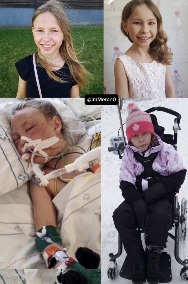 Patrioticos_RD's tweet photo. 🚨I 🇸🇪 #TERRIFICO | Luna, una niña sueca de 10 años sufrió un daño cerebral catastrófico después de que un migrante etíope la atacara brutalmente, violandola cuando tenía 9 años💔
1/4 https://t.co/AMVh3fu1Bi