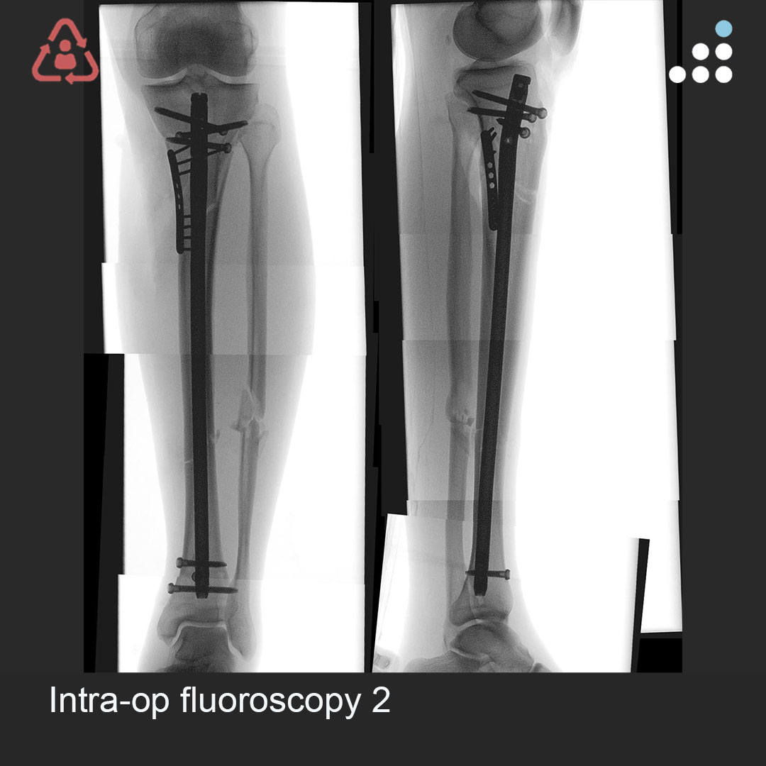 Orthobullets tweet media