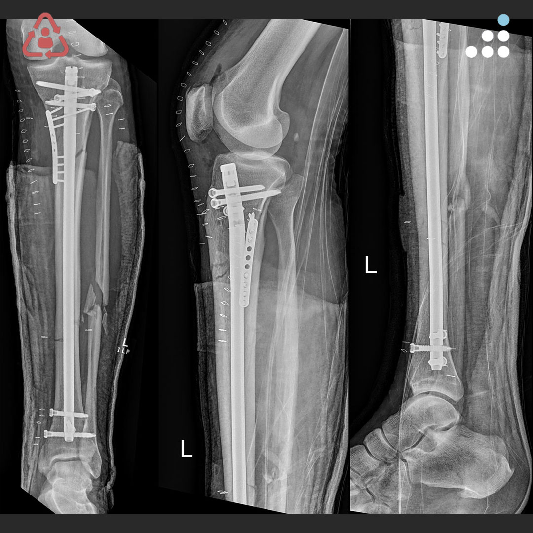 Orthobullets tweet media