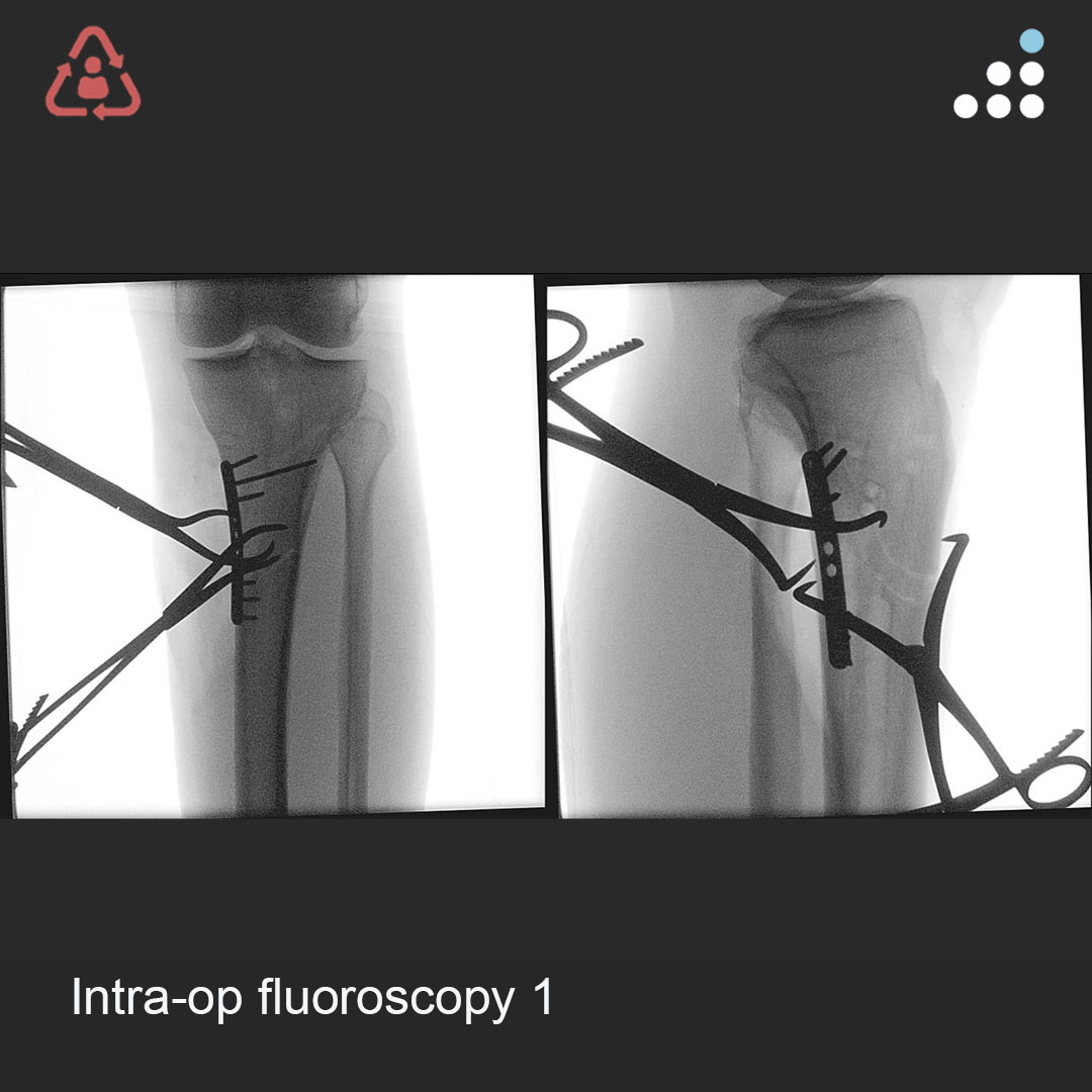 Orthobullets tweet media