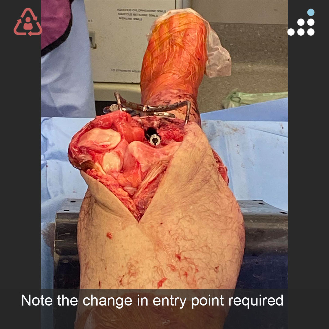 Orthobullets tweet media