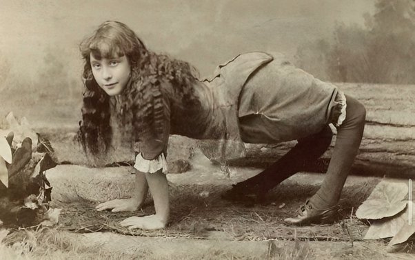 Ella Harper suffered from a highly uncommon medical condition called congenital genu recurvatum, which caused her knees to bend in the opposite direction. As a result, she found it more comfortable to move on all fours.

In 1886, Harper joined a circus as a performer. She earned