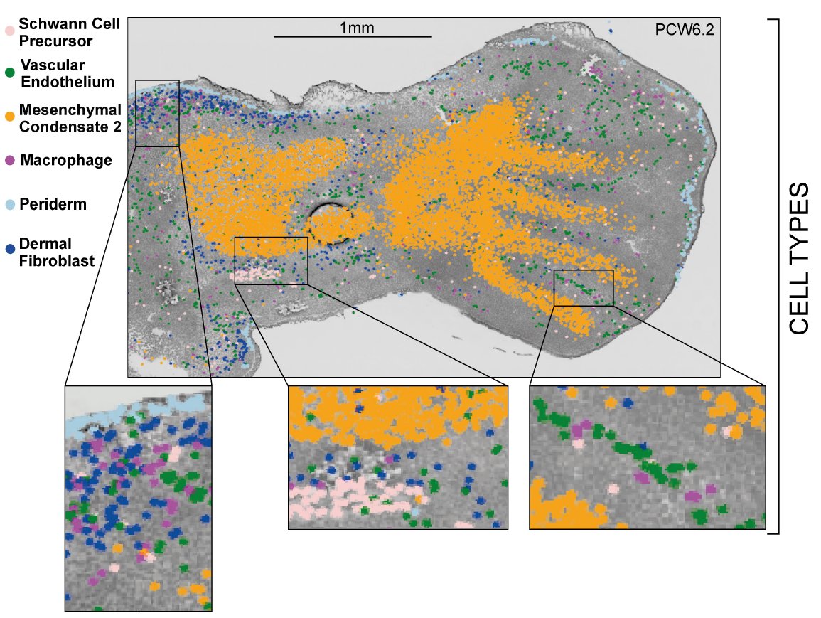 teichlab's tweet photo. 6β£We would like to thank all those involved in this project from @sangerinstitute, @OfficialUoM, @CambridgeOrtho1, @Cambridge_Uni, and @humancellatlas. #Research #ChondrocyteDevelopment #RegenerativeMedicine #ScienceTwitter #SingleCellRNASeq #TissueEngineering #CartilageDevAtlas https://t.co/i9aYlW2Omn