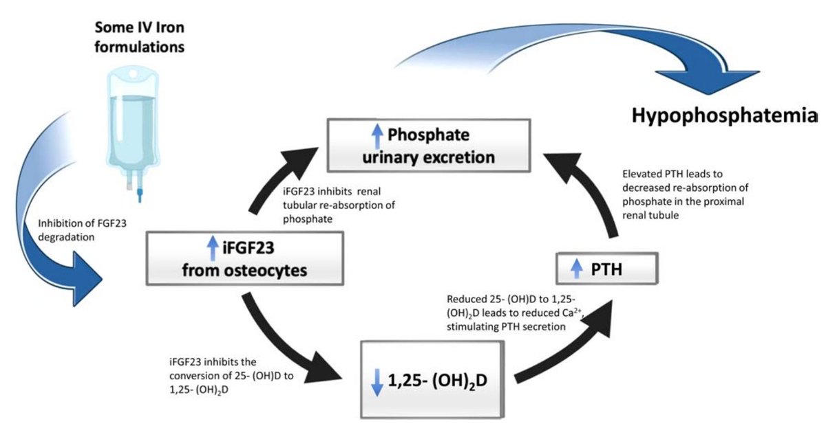 We all know that IV iron can cause HYPOPHOSPHATEMIA !

This is the pathophysiology behind it 👇🏼

Image credit: Van Doren et Al, #ASH23

#MedTwitter