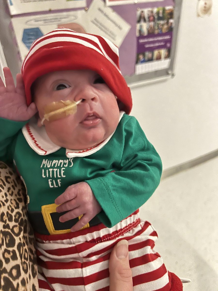 neonatalunitbgh's tweet photo. "Did someone say father Christmas is coming?!?"
Little Eli has been a good boy and hoping he's going to get lots of presents 🎁 🎅🎄
#barnsleynnu #babyelf #christmas2023 https://t.co/GY2FsYvJkD