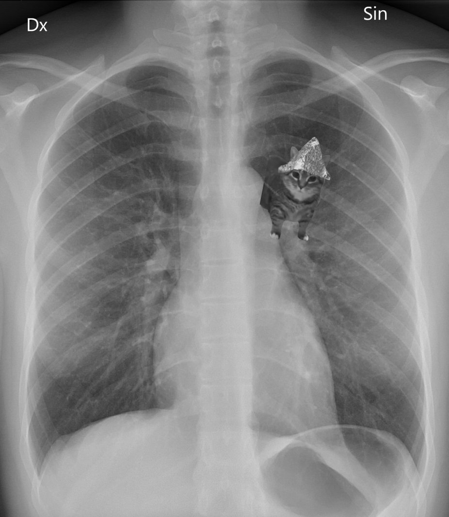 WayneWallace998's tweet photo. Just made a health check at my local doctor, my heart is fine $tin https://t.co/4iRgOLbdF4