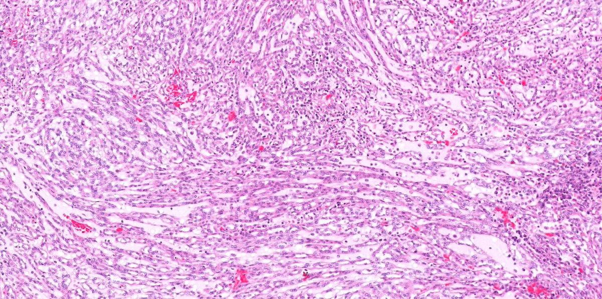 Katrina Collins, MD || Pathologist tweet media