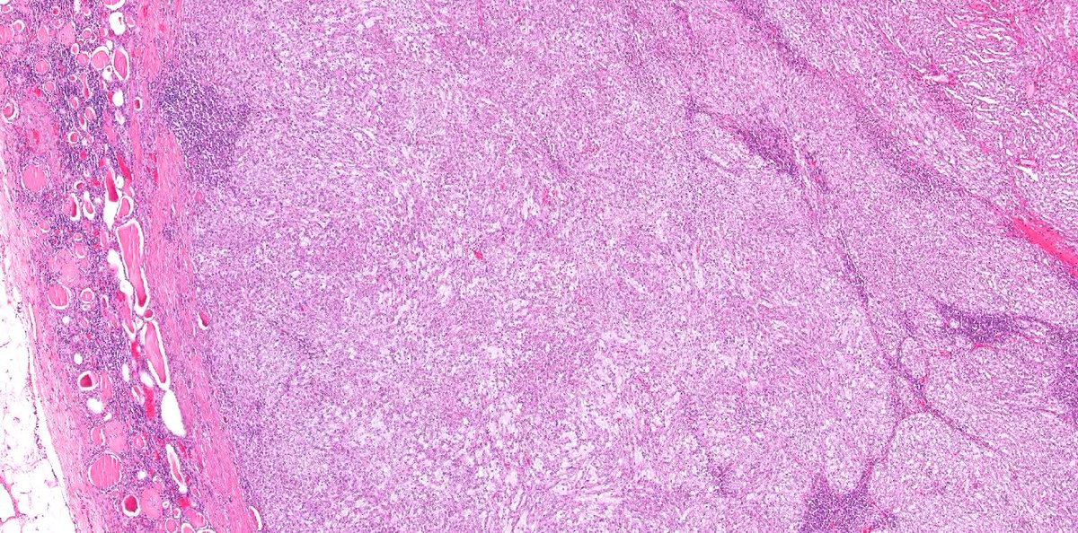 Katrina Collins, MD || Pathologist tweet media