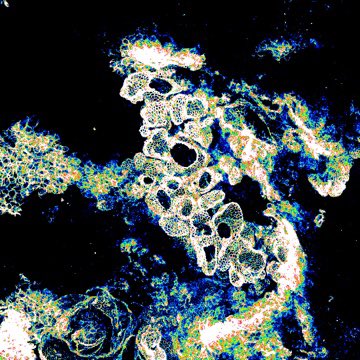 To our collaborators, colleagues and friends, have a very Happy Christmas and wonderful 2024. These festive liver cysts were made by deleting Wdr35 in the bile duct of mice and models PLD. Find out more here: science.org/doi/10.1126/sc… <a href="/ScienceTM/">Science Translational Medicine</a> #livertwitter
