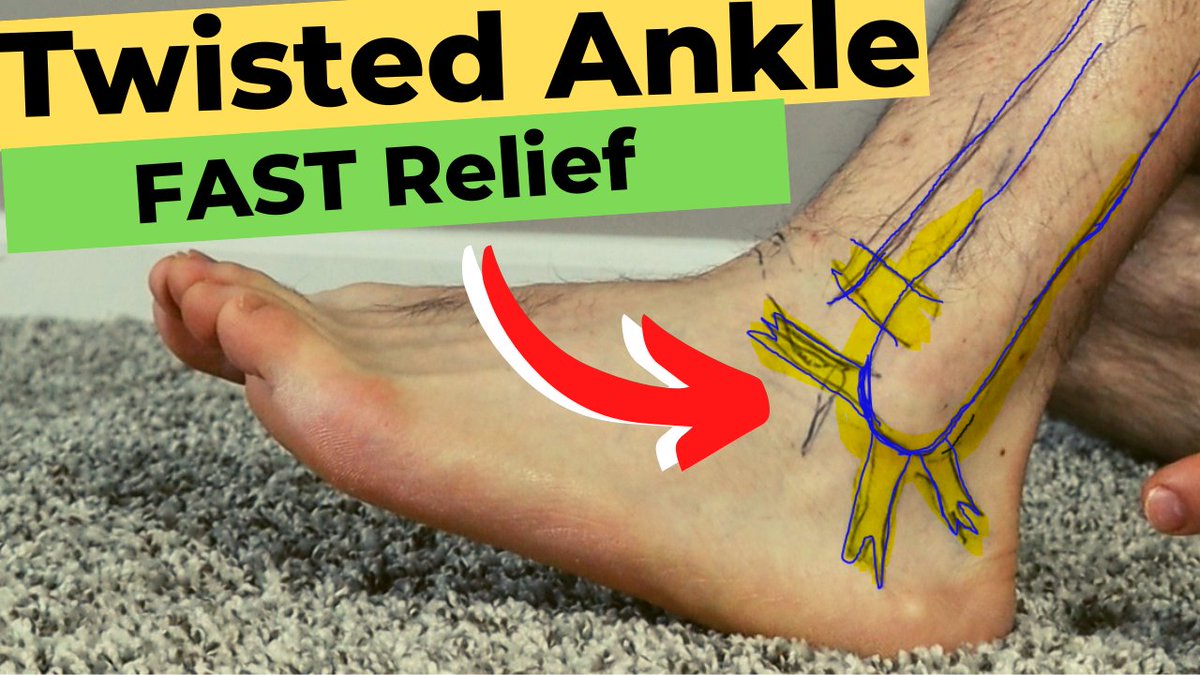 𝐅𝐢𝐱 𝐓𝐖𝐈𝐒𝐓𝐄𝐃 𝐀𝐧𝐤𝐥𝐞, 𝐑𝐎𝐋𝐋𝐄𝐃 𝐀𝐧𝐤𝐥𝐞 𝐨𝐫 𝐒𝐏𝐑𝐀𝐈𝐍𝐄𝐃 𝐀𝐧𝐤𝐥𝐞 𝐋𝐢𝐠𝐚𝐦𝐞𝐧𝐭𝐬 𝐅𝐀𝐒𝐓𝐄𝐑!
youtu.be/0yBrkVUgMkY

#podiatry #podiatrist #health #foothealth #footcare #ankle  #TwistedAnkle #ankleinjuries #anklepain #SprainedAnkle #rehabilitation