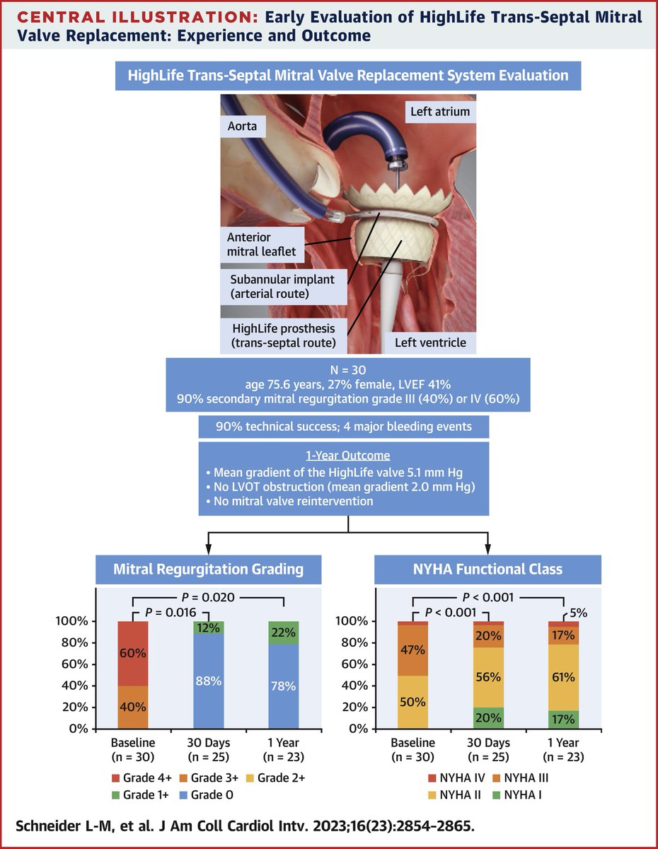 1-yr results from the HighLife #TSMVR feasibility study demonstrate a high technical success rate, excellent valve function, no #LVOT obstruction, &amp; no need for mitral valve reintervention. Add'l patient outcomes &amp; longer follow-up are needed bit.ly/41vyBu4 #JACCINT