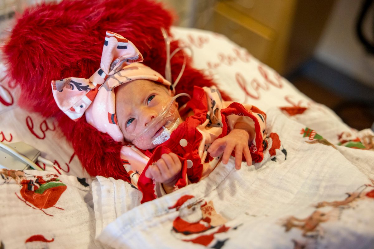 MassGeneralNews's tweet photo. Babies in the @mghfc neonatal intensive care unit (NICU) are ready to celebrate their first holiday season. Donning party dresses and cozy hats, the infants met Santa Clause, more commonly known as Kevin Raskin, MD, chief of the Orthopedic Oncology Service. https://t.co/jTDgJUqsA9