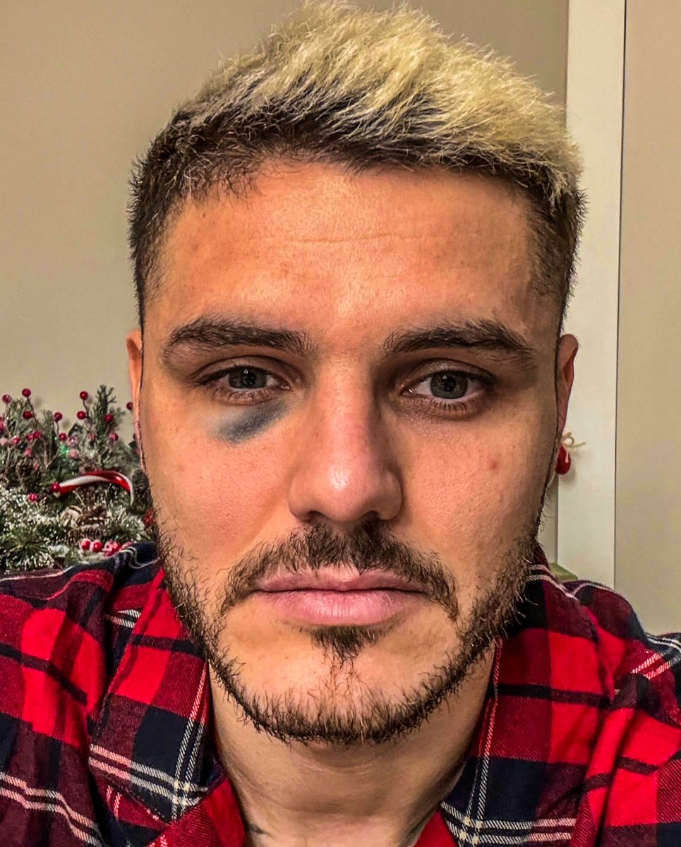 eurofootcom's tweet photo. 🚨🇹🇷 Galatasaray statement: "Those who only want justice for themselves continued to manipulate Turkish football from every channel tonight!" 

"VAR room and 26 cameras cannot see and we feel ashamed on their behalf. We hope that one day those who brought Turkish football to this point will be ashamed."