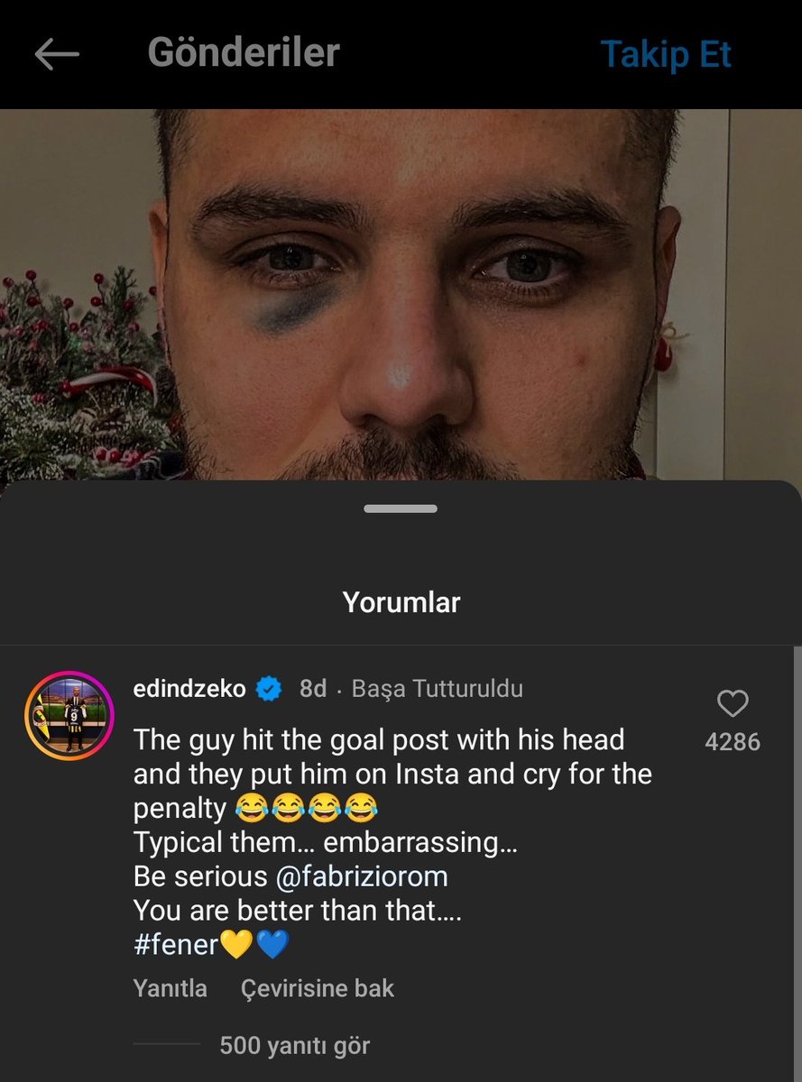 #SONDAKİKA | Edin Dzeko'dan, Fabrizio Romano'nun Icardi paylaşımına cevap: "Adam direğe vurdu ama penaltı diye koyup ağladılar.. Tipik onlar.. Utanç verici. Ciddi ol Fabrizio, sen bundan iyisin.."