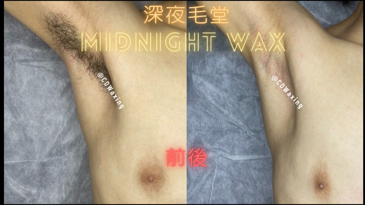 CDWaxing's tweet photo. 私密部有整理的男生加分👍🏼
腋下也整理的男生加加加加加加分🥰
直接加爆💥

胸部的毛不用再拔了熱蠟直接讓胸部乾淨溜溜～😎

#桃園 #熱蠟除毛 #深夜毛堂 #男仕熱蠟除毛 #偽娘 #獨立工作室 #腋下除毛 #除毛作品 https://t.co/EIeYm5FWdA