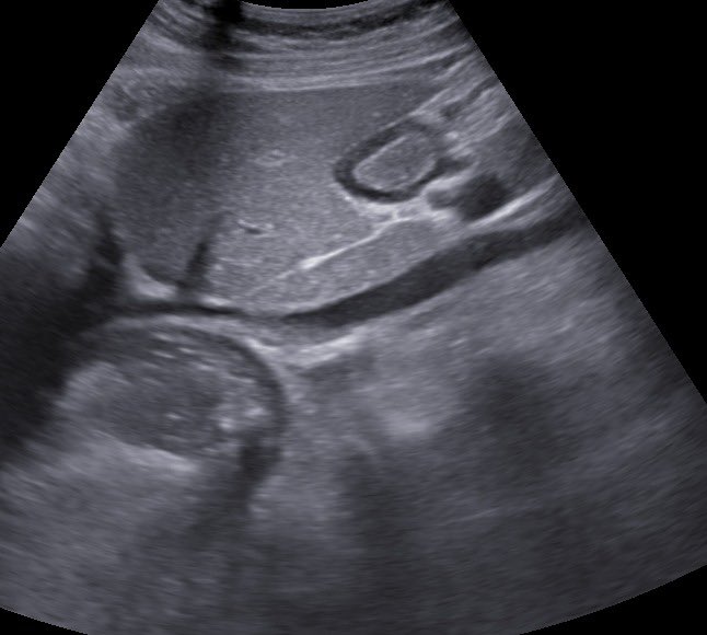 🩺 Hari (హరి 🇮🇳) Kalagara tweet media