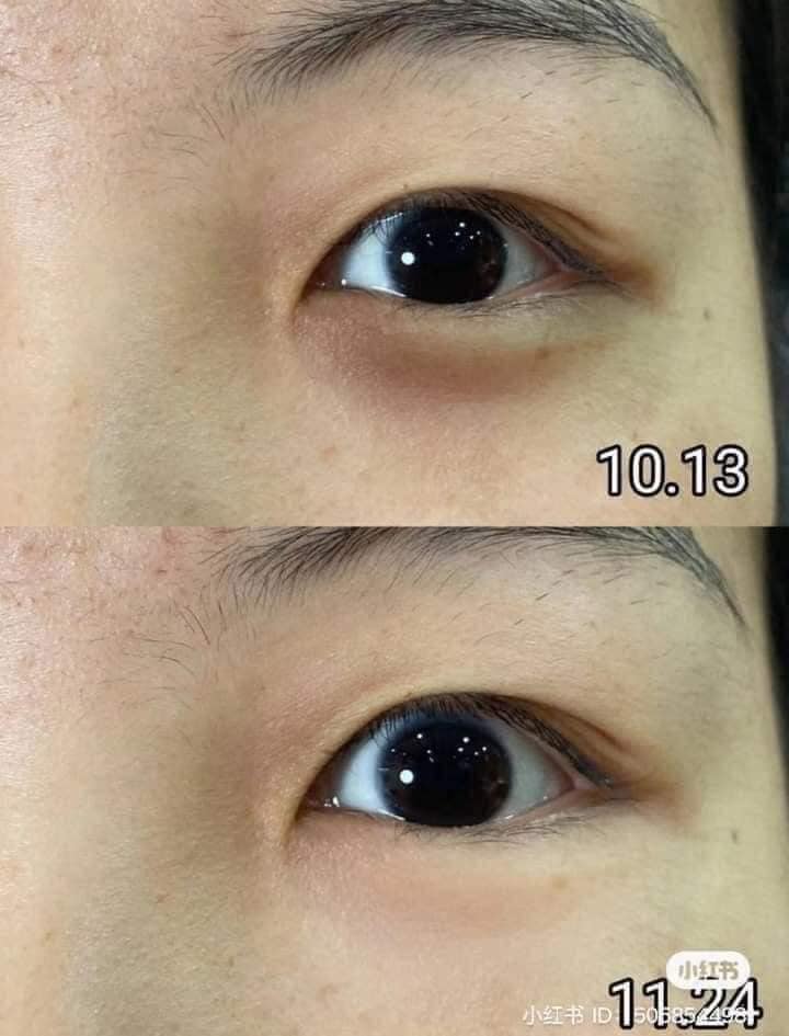 mediahien's tweet photo. Cái này hiệu quả thật nè các bạn ơi.. https://t.co/5kW2STIZpJ