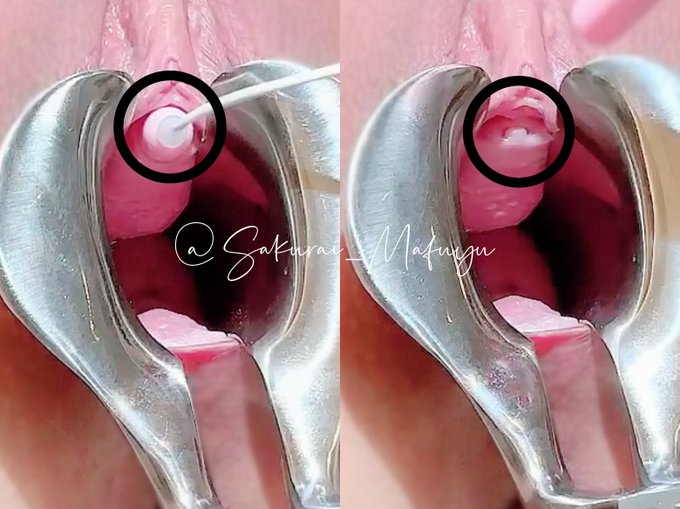 mnkをびょーんしたときのおしっこの穴はここですよという資料を作りましたのでご査収ください。この状態だととても尿道に挿れにくかったのですが海外ネキはみんなこれでぐわーしてじゅっぽじゅぽ尿道ふぁっくしてるのできっと私の鍛錬が足りないんだと思います。めりーにょどります。<a href="/tag/%E7%8C%AB%E3%81%8B%E3%82%8F%E3%81%84%E3%81%84%E3%81%AD"class="tags"><span>#猫かわいいね</span></a>