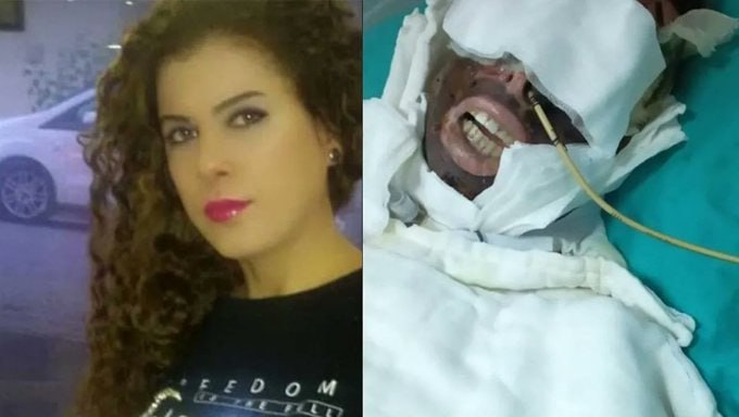 muhendisyenn's tweet photo. Avcılar'da saplantılı şekilde aşık olduğu Yasemin Uzunçelebi'den karşılık alamayınca başından aşağı kimyasal madde dökerek yüzündeki organların erimesine sebep olan şahsın iğrenç savunması:

Kasten öldürmeye teşebbüs suçlamasını kabul etmiyorum, öldürmek gibi bir niyetim olsaydı çok rahatlıkla öldürebilirdim.