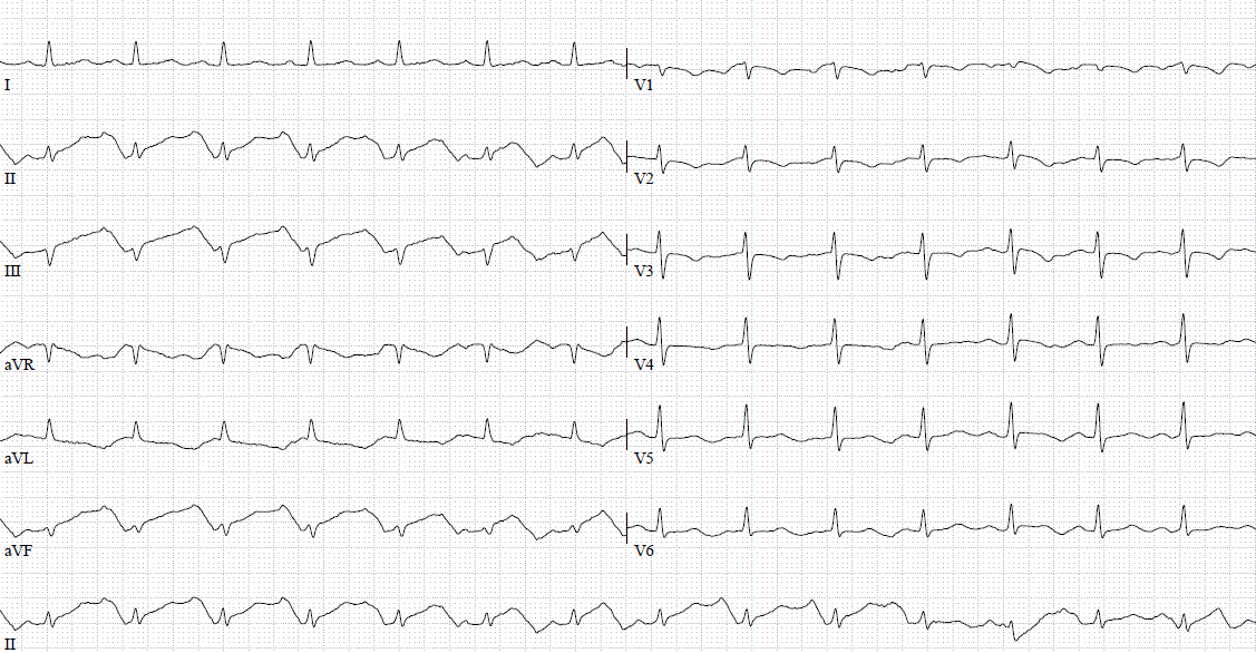 What is happening here? Routine examination of a ~60y/o male ...