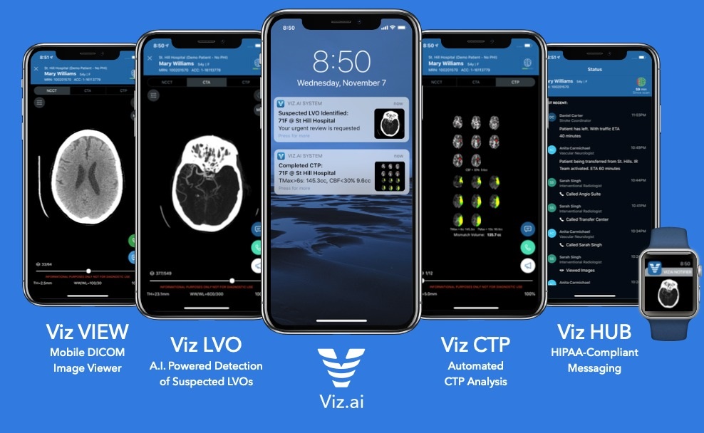 New AI Tools for early prediction of cardiac disease!
#cardiology, #aihealthcare, #healthcare