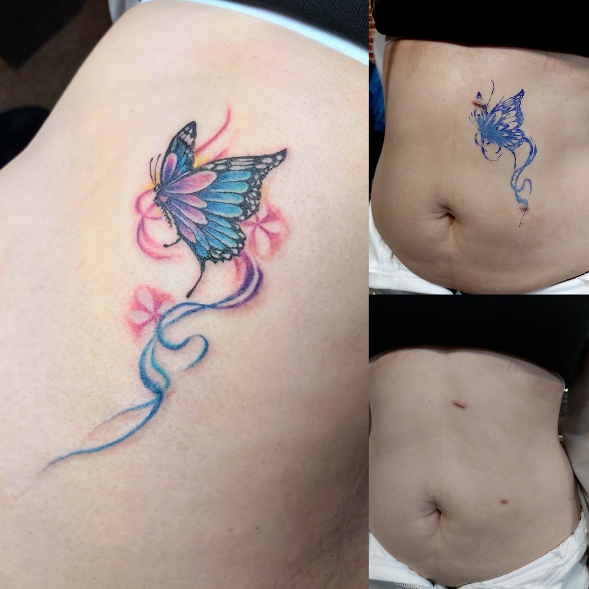 蝴蝶翩然而飛，蓋二點疤痕，刺青原本就有蓋疤的作用#tattooink 