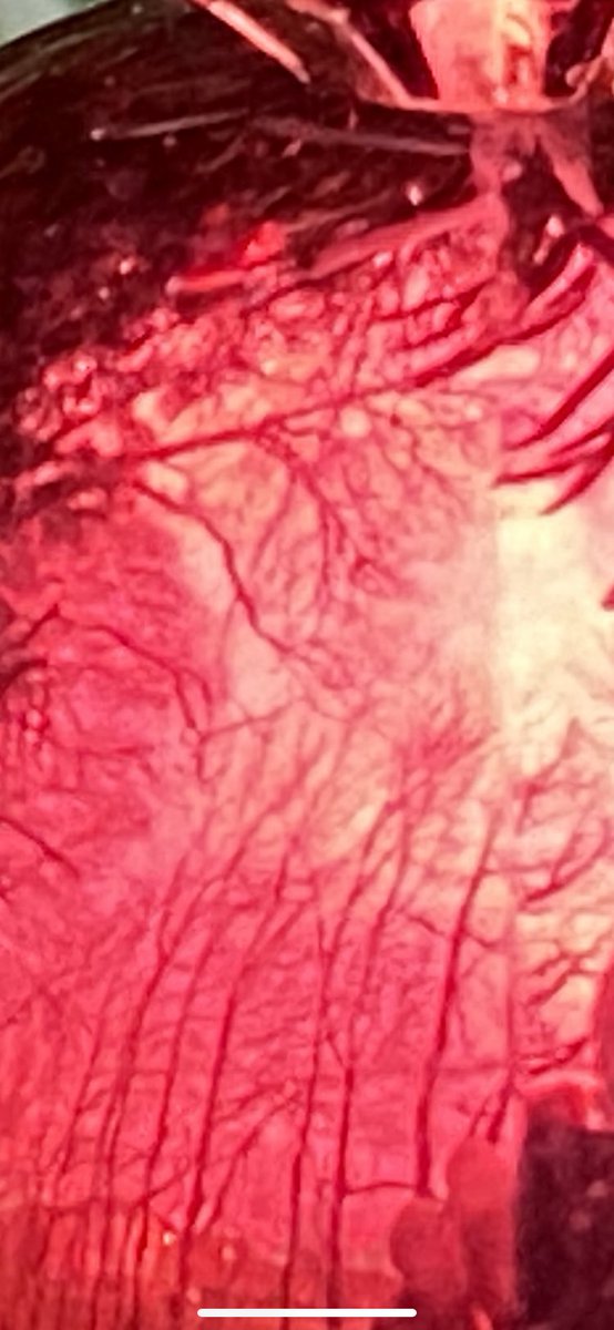 ℝ𝕠𝕓𝕤𝕠𝕟𝟟𝟚 tweet media