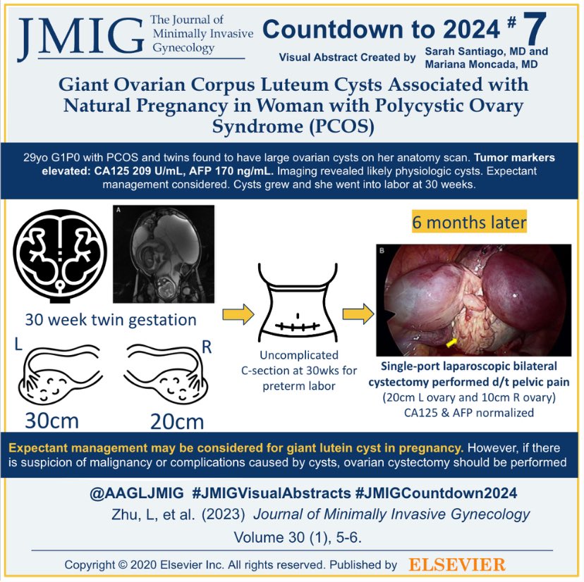 Countdown to 2024🕓 #7 most downloaded #JMIG article of 2023: Giant Ovarian Corpus Luteum Cysts Associated with Natural Pregnancy in Woman with Polycystic Ovary Syndrome 🤰 🔗 Link: buff.ly/3RVlpvu #JMIGVisualabstract #JMIGCountdown2024 #MIGS #Laparoscopy #PCOS