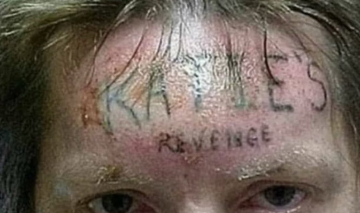 In 2006, Anthony Ray Stockelman was forcibly tattooed across his forehead with the words Katie’s revenge by another inmate after it was found out that he was serving time for raping and murdering a 10 year old child called Katie Collman.