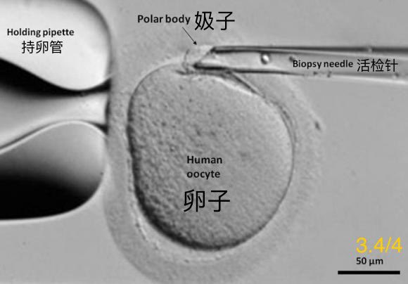 八一八更高级的繁衍方式：纯雌生殖。

单雌生殖，双雌生殖，大自然的灭男闪电战，神秘的超强buff“㚫子”，寿命加倍百毒不侵的进化雌性…尽在本频道！

第一集，纯雌生殖香喷喷，雌性灭雄稳准狠