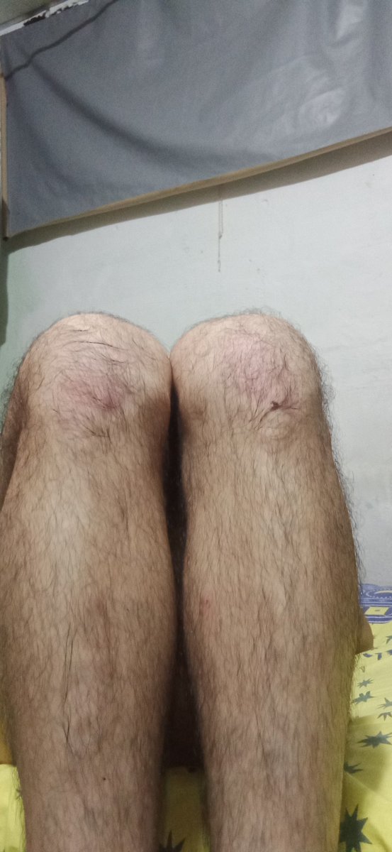 CuloProfesional's tweet photo. El niño Jesús llegó tarde, pero me recompensó con un riquísimo colágeno 😏😈
Así quedaron mis rodillas y mi 🍑
#EnElPiso #CuloSatisfecho https://t.co/8Dlv1ZcEO1
