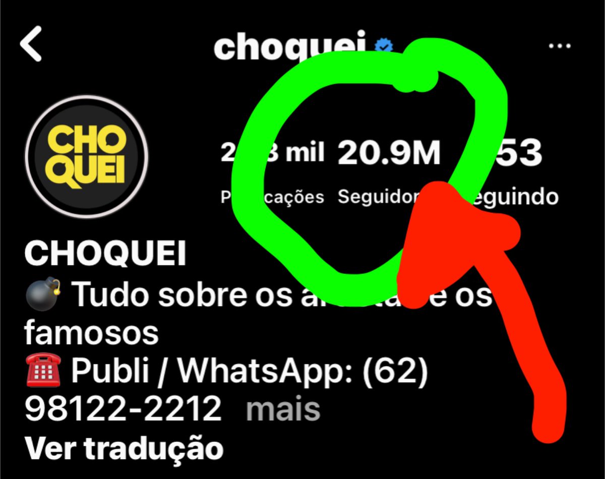 RenataDerib's tweet photo. #ChoqueiMatei 
povo não para de seguir isso🔥🔥🔥 https://t.co/Tir0r3TArH