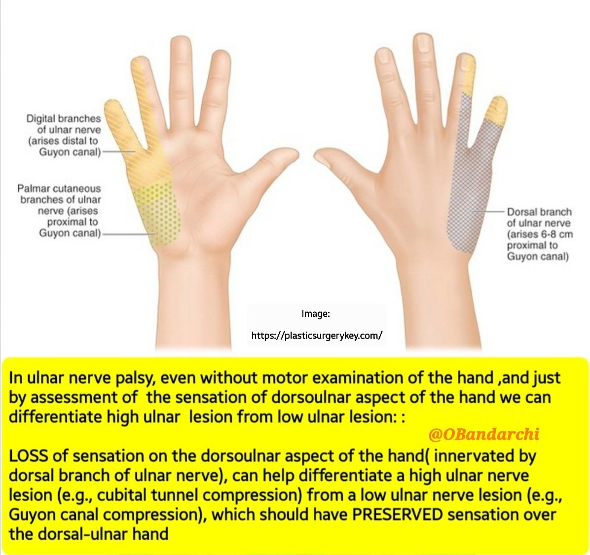 Dr. OMID BANDARCHI on X: Even without motor examination of hand